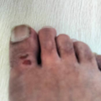 Bir Kez Giyilen Terlik Ayağı Kesti Mağduriyet Yaşadık