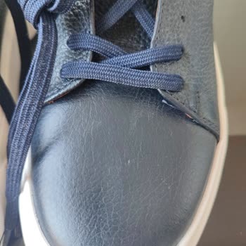 Lufian Ayakkabıda Taban Eksikliği Ve Deformasyon Mağduriyeti