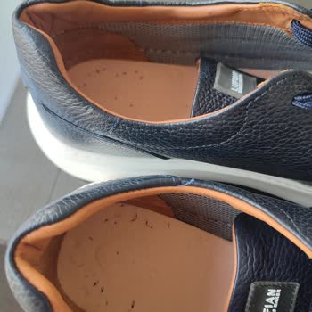 Lufian Ayakkabıda Taban Eksikliği Ve Deformasyon Mağduriyeti