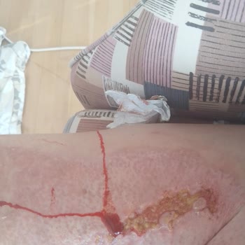 Faturalı Hattımda Haksız Kısıtlama Ve Mağduriyet