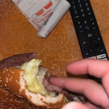 Whopper Menüde Hijyen Sorunu Yaşadım