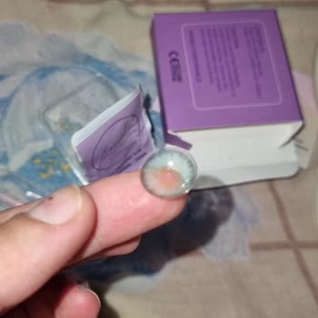 Lensin Yırtık Çıkması Ve Satıcının Sorumluluğu Reddetmesi