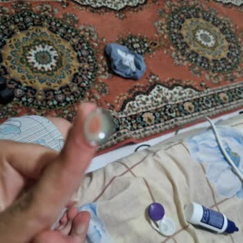 Lensin Yırtık Çıkması Ve Satıcının Sorumluluğu Reddetmesi