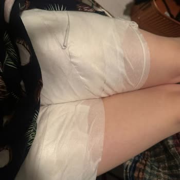 Sinbo Çaydanlık Kulpunun Kırılması Sonucu Yanık Yaşadım