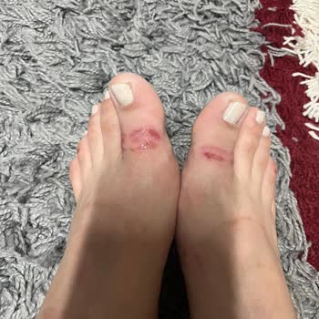 İlk Kullanımda Zarar Veren Terlik Mağduriyeti