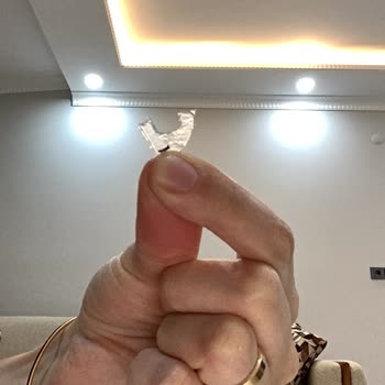 Hazır Künefeden Plastik Parça Çıktı, Sağlığım Tehlikeye Girdi