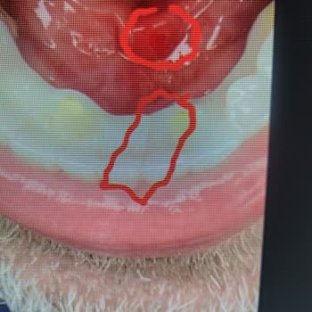 Dental Clinic Gave Me Faulty Full Dental Prostheses