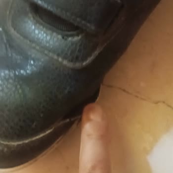 Adidas Ayakkabının Kısa Sürede Yıpranmasına FLO Mağazasından Çözüm Alamadım