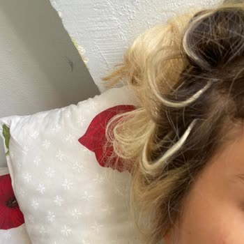 Kaynak Atölyesi (Mikrokaynak_bedirhan) Saç Kaynak İşlemi Sonrası Kötü Deneyim ve Saç Kaybı