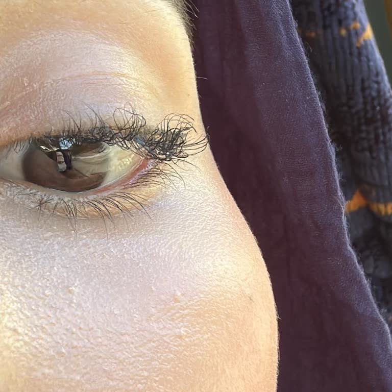 Lifting Sonrası Kirpiklerimde Yaşadığım Sorunlar