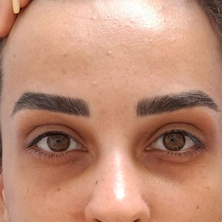 Düğünümde Kaş İşlemi Ve Sonrası Yaşadığım Mağduriyet