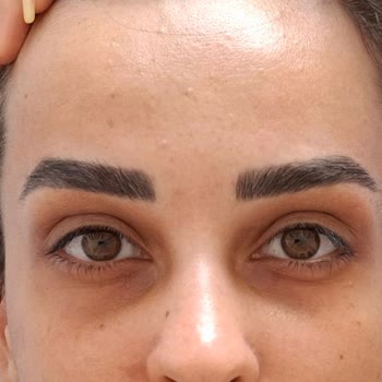 Eki aç