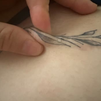 Estetik Operasyon Sonrası Beklentilerimin Karşılanmaması Ve Kalıcı İzler