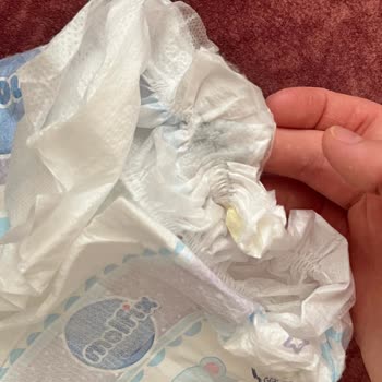 Molfix Bebek Bezinde Yabancı Cisim Şoku