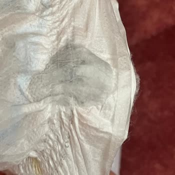 Molfix Bebek Bezinde Yabancı Cisim Şoku