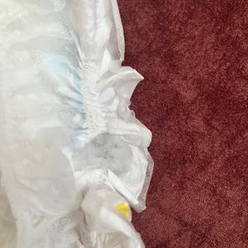 Molfix Bebek Bezinde Yabancı Cisim Şoku