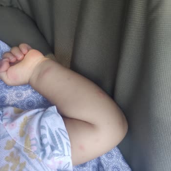 Babyton Natural Cosmetics Bebek İçin Aldığım Sprey Sineklere Karşı Etkisiz Kaldı