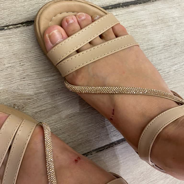 Aldığım Terlik Ayaklarımı Yaraladı İade Sürecinde Mağdur Edildim