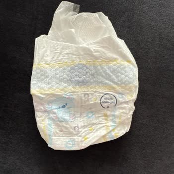 Molfix Bebek Bezinde İç Dolgu Eksikliğiyle Yaşadığım Mağduriyet