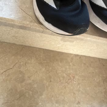 Trendyol Aldığım Adidas Ayakkabıda Kronik Patlama Sorunu Ve Kullanıcı Hatası Geri Bildirimi