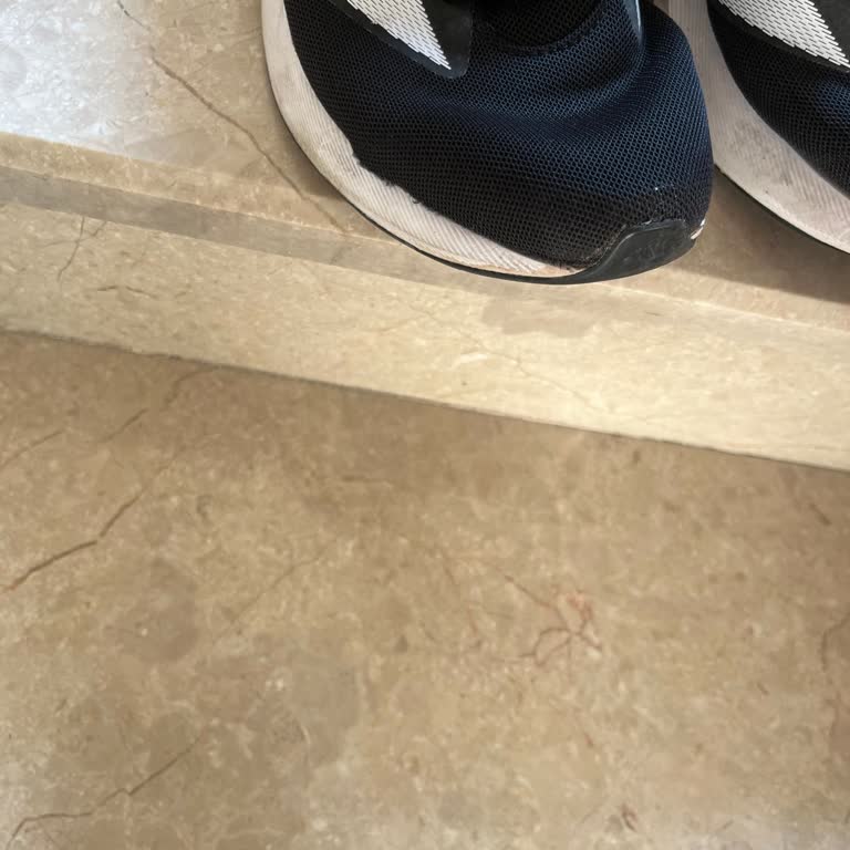 Trendyol Aldığım Adidas Ayakkabıda Kronik Patlama Sorunu Ve Kullanıcı Hatası Geri Bildirimi