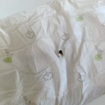 Bebek Bezinden Çıkan Büyük Tahta Parçası Güvenimizi Sarstı