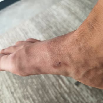 Greyder'den Aldığım Deri Terlik Ayağımı Yaraladı, Mağaza Sorunumu Çözmedi