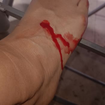 Greyder'den Aldığım Deri Terlik Ayağımı Yaraladı, Mağaza Sorunumu Çözmedi