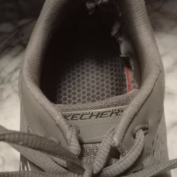 Aynı Mağazada İki Kez Ayakkabı Deformasyonu Ve Garanti Sorunu