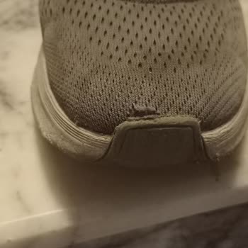 Aynı Mağazada İki Kez Ayakkabı Deformasyonu Ve Garanti Sorunu