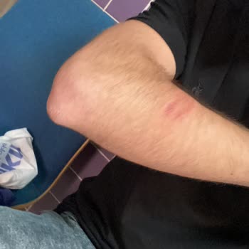 Otobüs Şoföründen Şiddet Görmek Kabul Edilemez