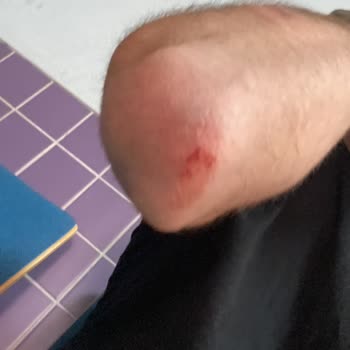 Otobüs Şoföründen Şiddet Görmek Kabul Edilemez