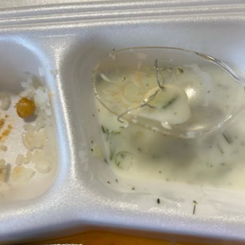 Kadın Doğum Servisinde Yemeğimden Bulaşık Teli Çıktı, Büyük Hijyen Sorunu