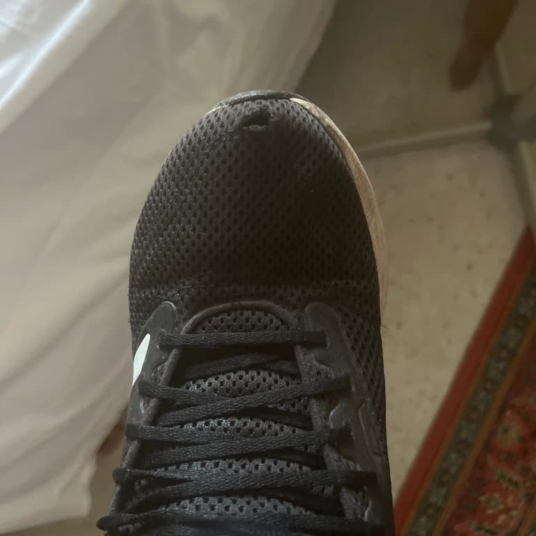 Adidas Ayakkabımın Üst Filesi Durduk Yere Yırtıldı