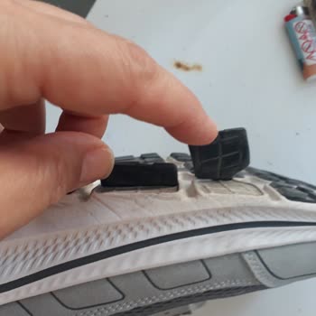 Skechers Ayakkabıda Açılma Sorunu Ve Yetersiz Satış Sonrası Destek Hayal Kırıklığı