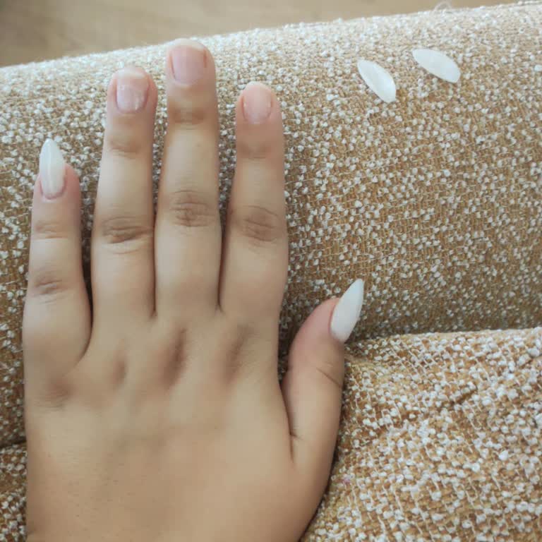 Protez Tırnakta Kötü Hizmet Ve İlgisiz Yaklaşım Nedeniyle Mağduriyet