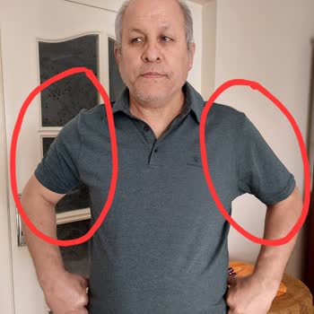 Hatalı Dikişli Ürün İçin Çözüm Sunulmadı, Mağdur Edildim