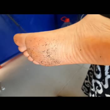 FLO Mağazasında Terlik Şikayetim Hızlıca Reddedildi, Çözüm Bekliyorum