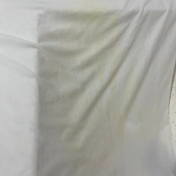 Nivea Sun Güneş Kremi Sarı Leke Sorunu