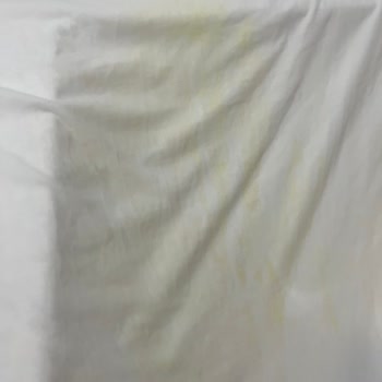 Nivea Sun Güneş Kremi Sarı Leke Sorunu