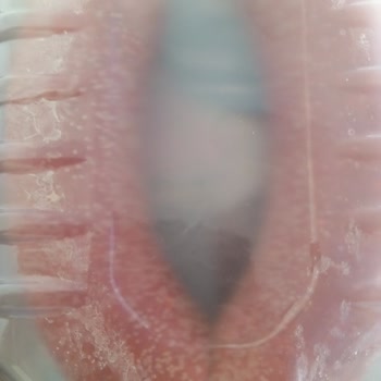 Migros Sanal Marketten Küflenmiş Ürün Ve İlgisiz Müşteri Hizmeti