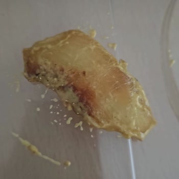 Çiğ Gelen Tavuklar Nedeniyle Yaşadığımız Sağlık Sorunu