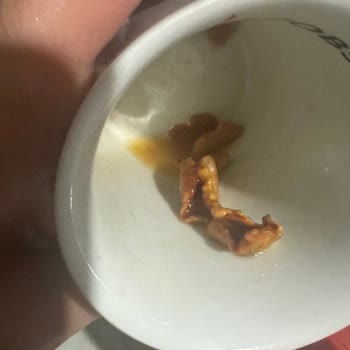 Dimes Meyve Suyunda Son Kullanma Tarihi Geçmemişken Çıkan Yabancı Maddeler Şaşkınlık Yarattı