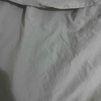 Trençkotta Tüylenme Ve Renk Atması Hayal Kırıklığı Yarattı