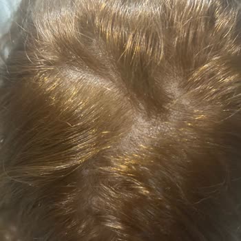 Sterk Değişim Salonu Hatalarını Kabul Etmediler