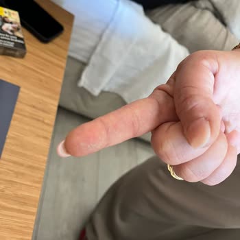 Otel Hijyen Sorunları Ve Kötü Müşteri Deneyimi Tatili Zehir Etti