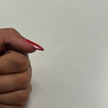 Uzman Değişikliği Ve İlgisizlik Nedeniyle Mağduriyet Yaşadım