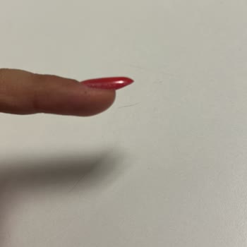 Uzman Değişikliği Ve İlgisizlik Nedeniyle Mağduriyet Yaşadım