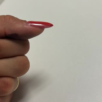 Uzman Değişikliği Ve İlgisizlik Nedeniyle Mağduriyet Yaşadım