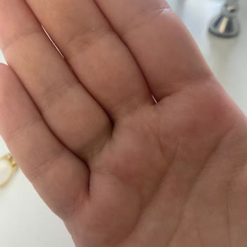 Doğum Günü Hediyesi Yüzük Hem Rengini Kaybetti Hem Hayal Kırıklığı Yarattı